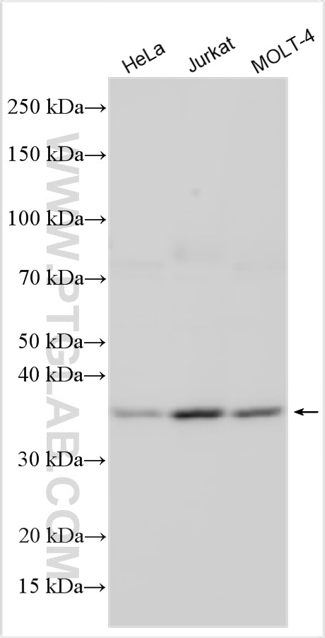 Western Blot (WB) analysis of various lysates using RFXAP Polyclonal antibody (20188-1-AP)
