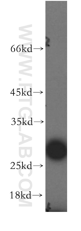 Western Blot (WB) analysis of HeLa cells using RFXAP Polyclonal antibody (20188-1-AP)