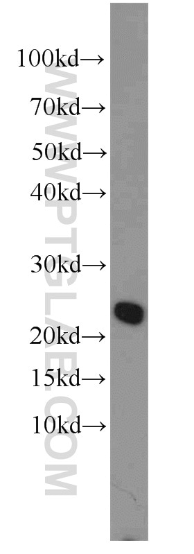 Western Blot (WB) analysis of HeLa cells using RFXAP Polyclonal antibody (20188-1-AP)