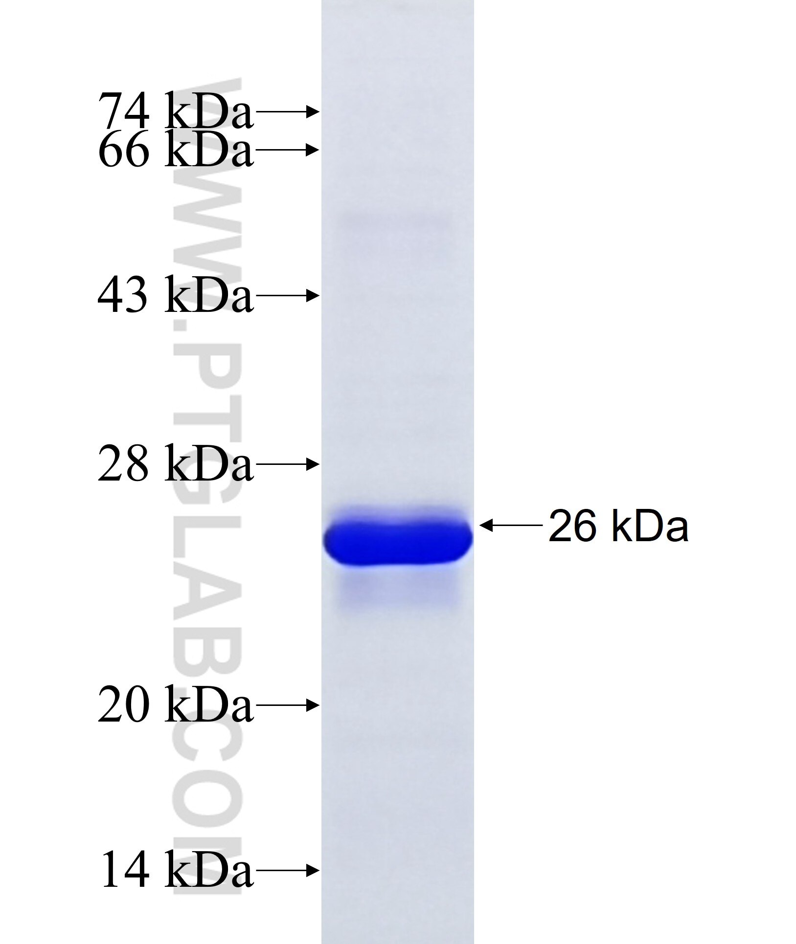 RG9MTD3 fusion protein Ag36955 SDS-PAGE RG9MTD3 fusion protein Ag36955 SDS-PAGE