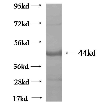 RGAG1 fusion protein Ag20407 SDS-PAGE