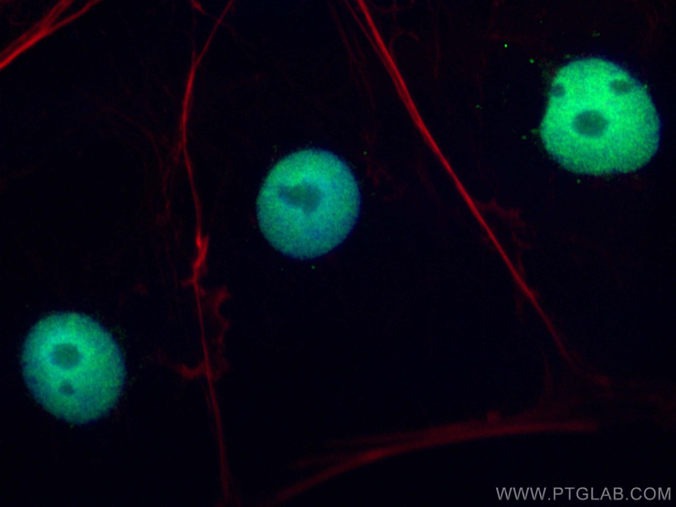 Immunofluorescence (IF) / fluorescent staining of Caco-2 cells using RGC32 Polyclonal antibody (19556-1-AP)