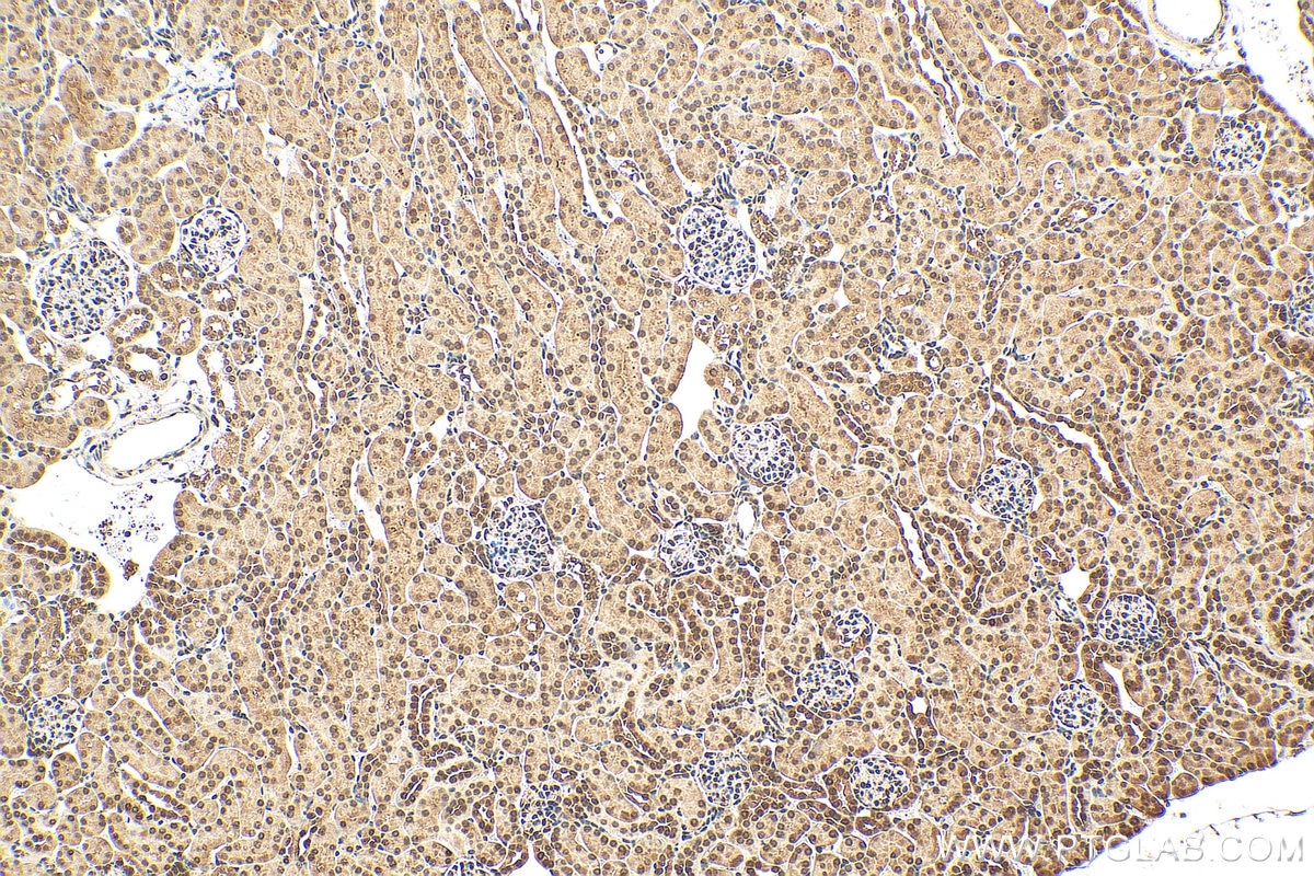 IHC staining of mouse kidney using 19556-1-AP