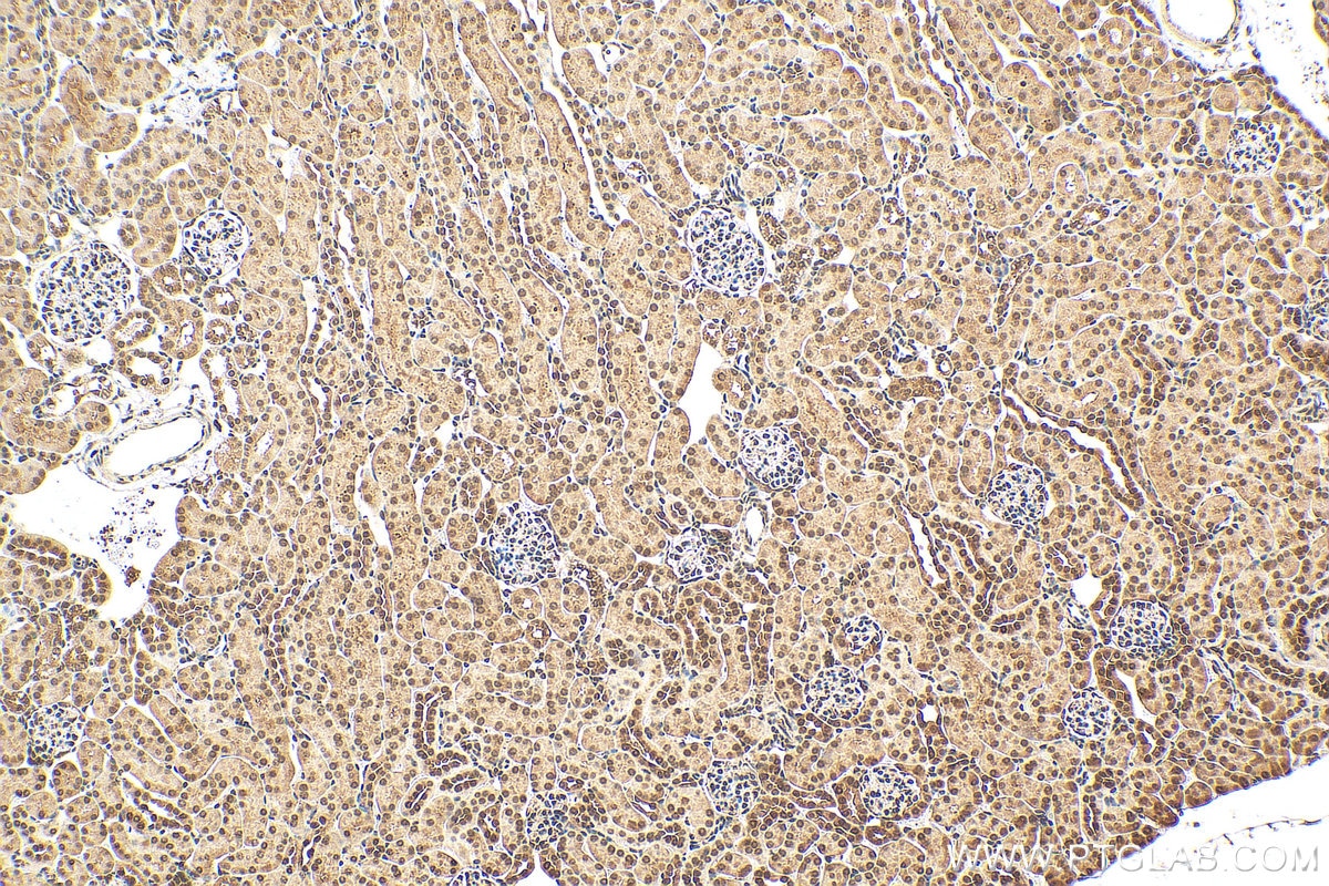 Immunohistochemistry (IHC) staining of mouse kidney tissue using RGC32 Polyclonal antibody (19556-1-AP)