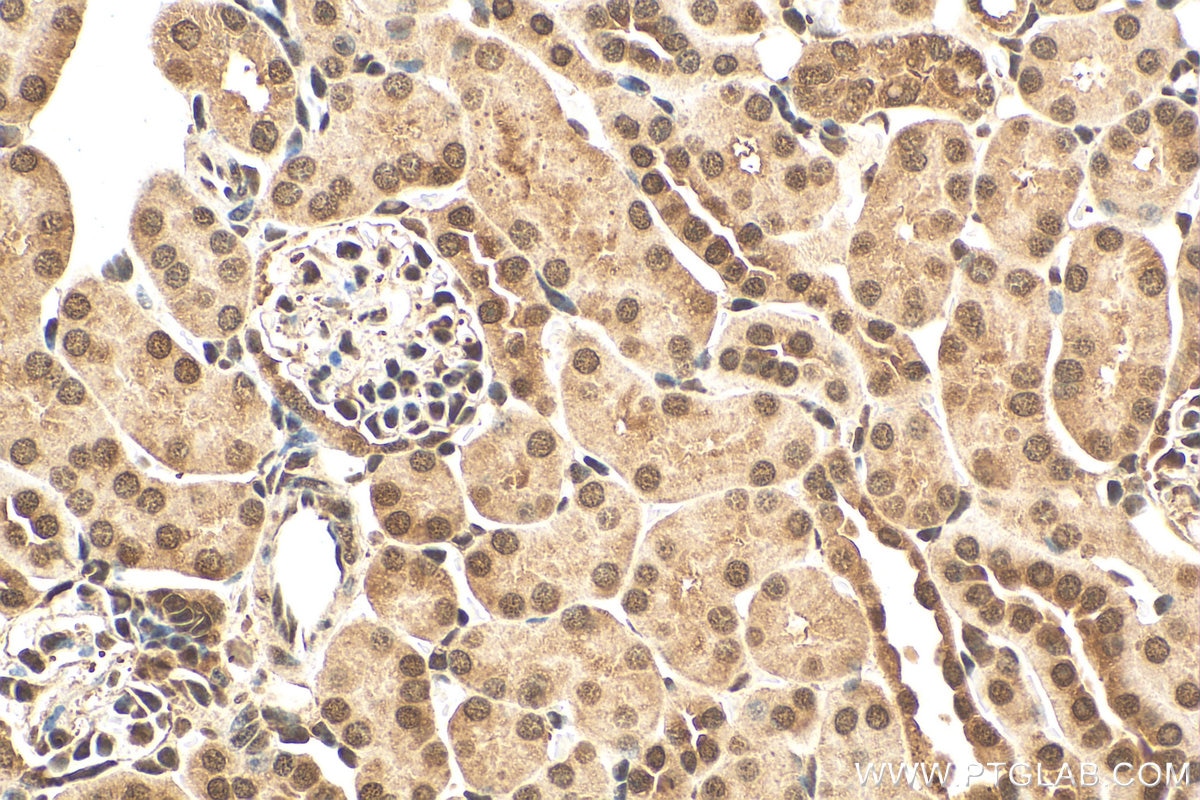 Immunohistochemistry (IHC) staining of mouse kidney tissue using RGC32 Polyclonal antibody (19556-1-AP)