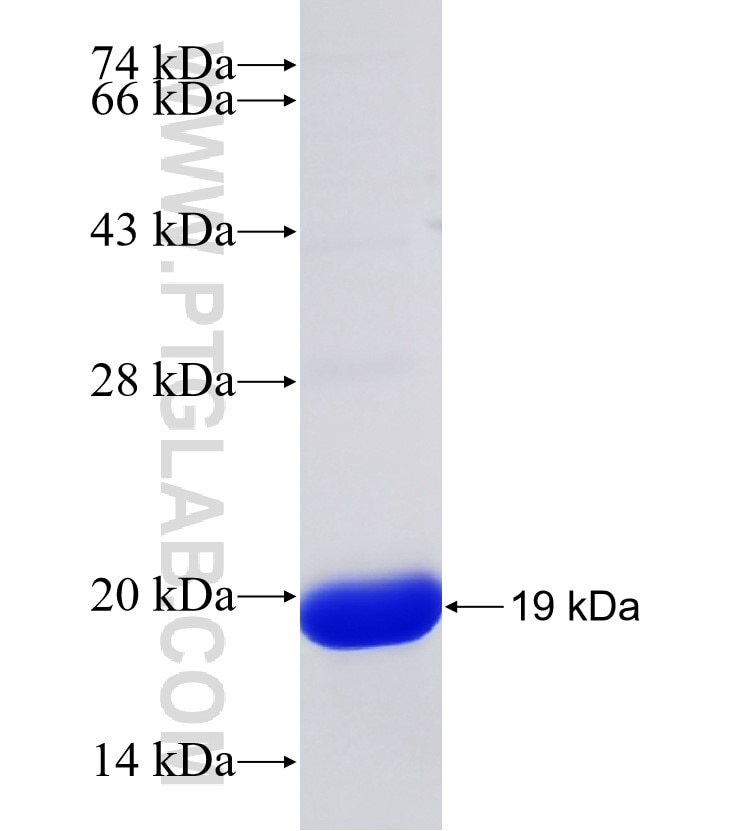 RGC32 fusion protein Ag30586 SDS-PAGE RGC32 fusion protein Ag30586 SDS-PAGE