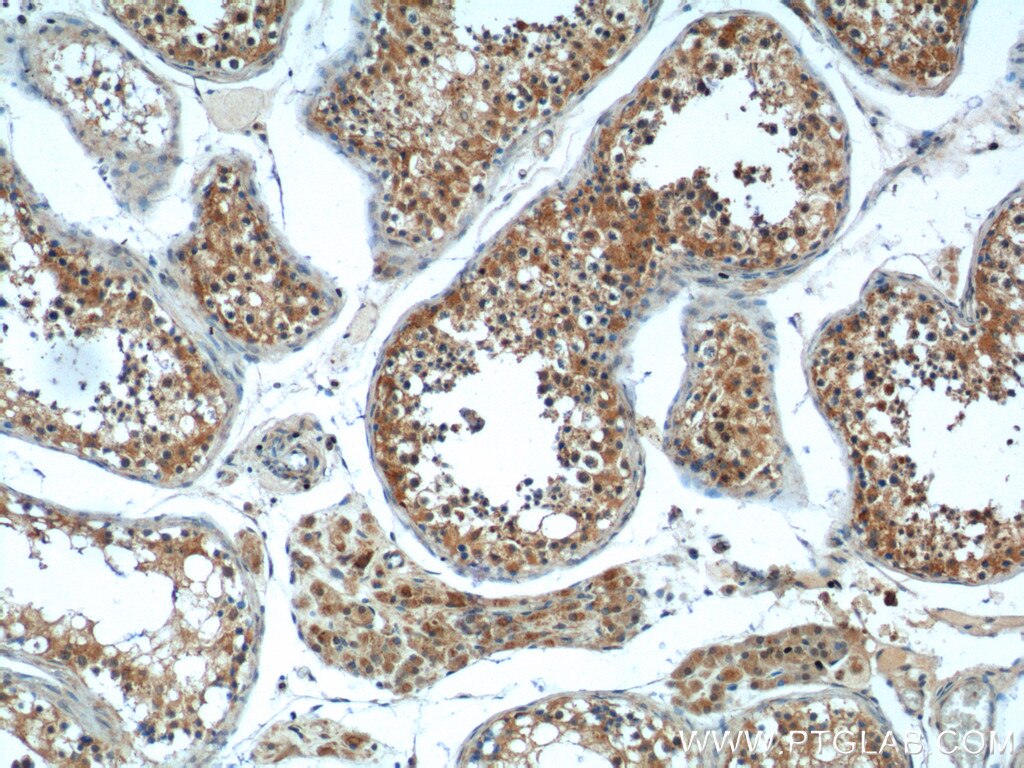 Immunohistochemistry (IHC) staining of human testis tissue using RGL1 Polyclonal antibody (25924-1-AP)