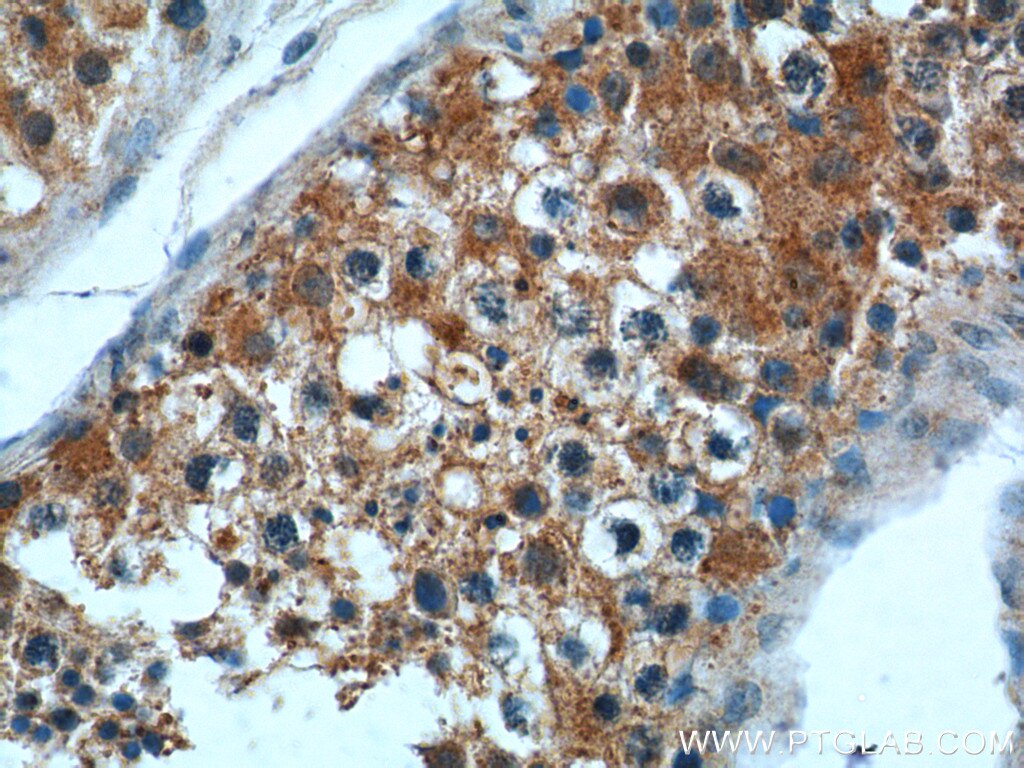 Immunohistochemistry (IHC) staining of human testis tissue using RGL1 Polyclonal antibody (25924-1-AP)