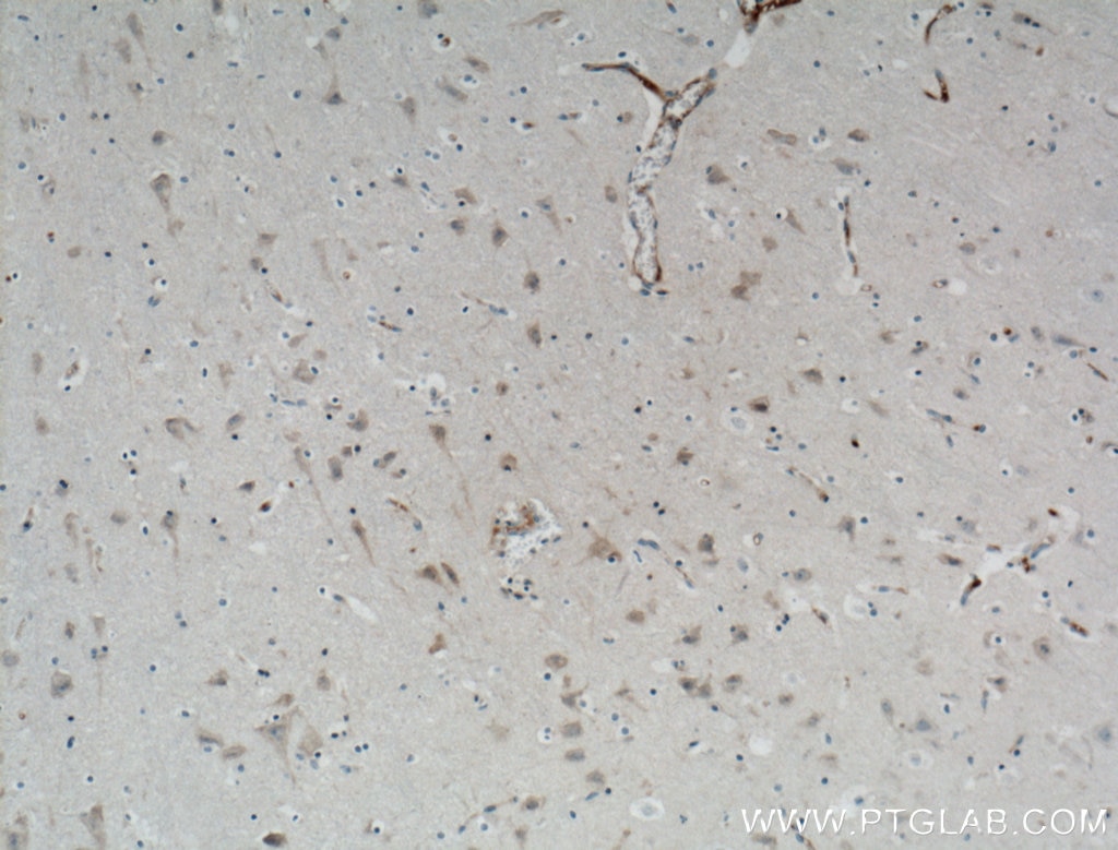 Immunohistochemistry (IHC) staining of human brain tissue using RGMA Polyclonal antibody (12387-1-AP)