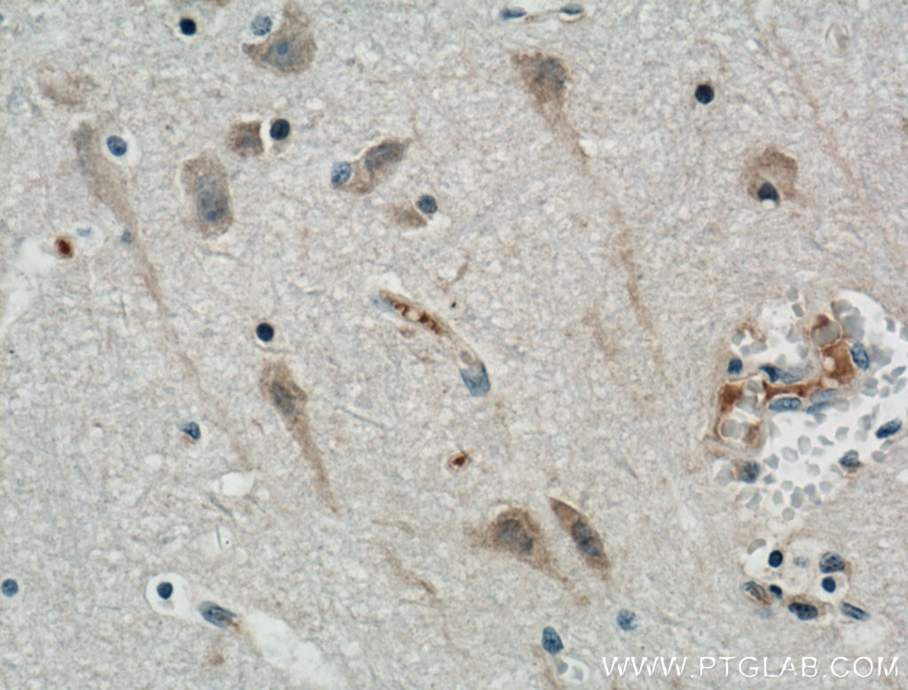 Immunohistochemistry (IHC) staining of human brain tissue using RGMA Polyclonal antibody (12387-1-AP)