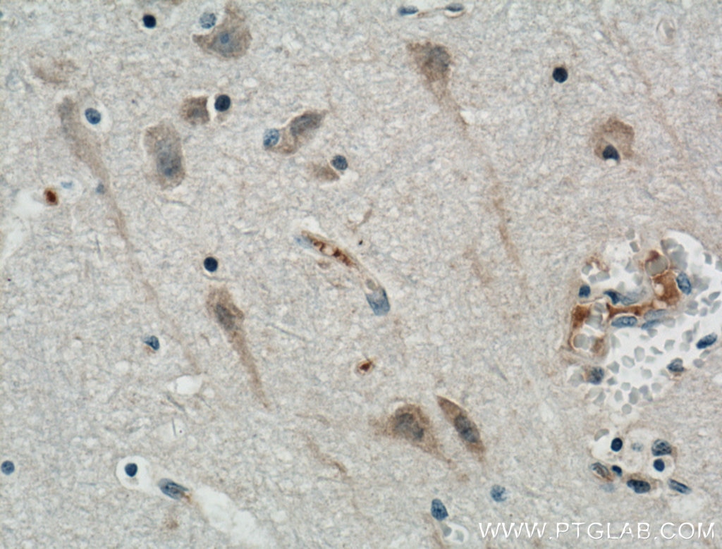 IHC staining of human brain using 12387-1-AP