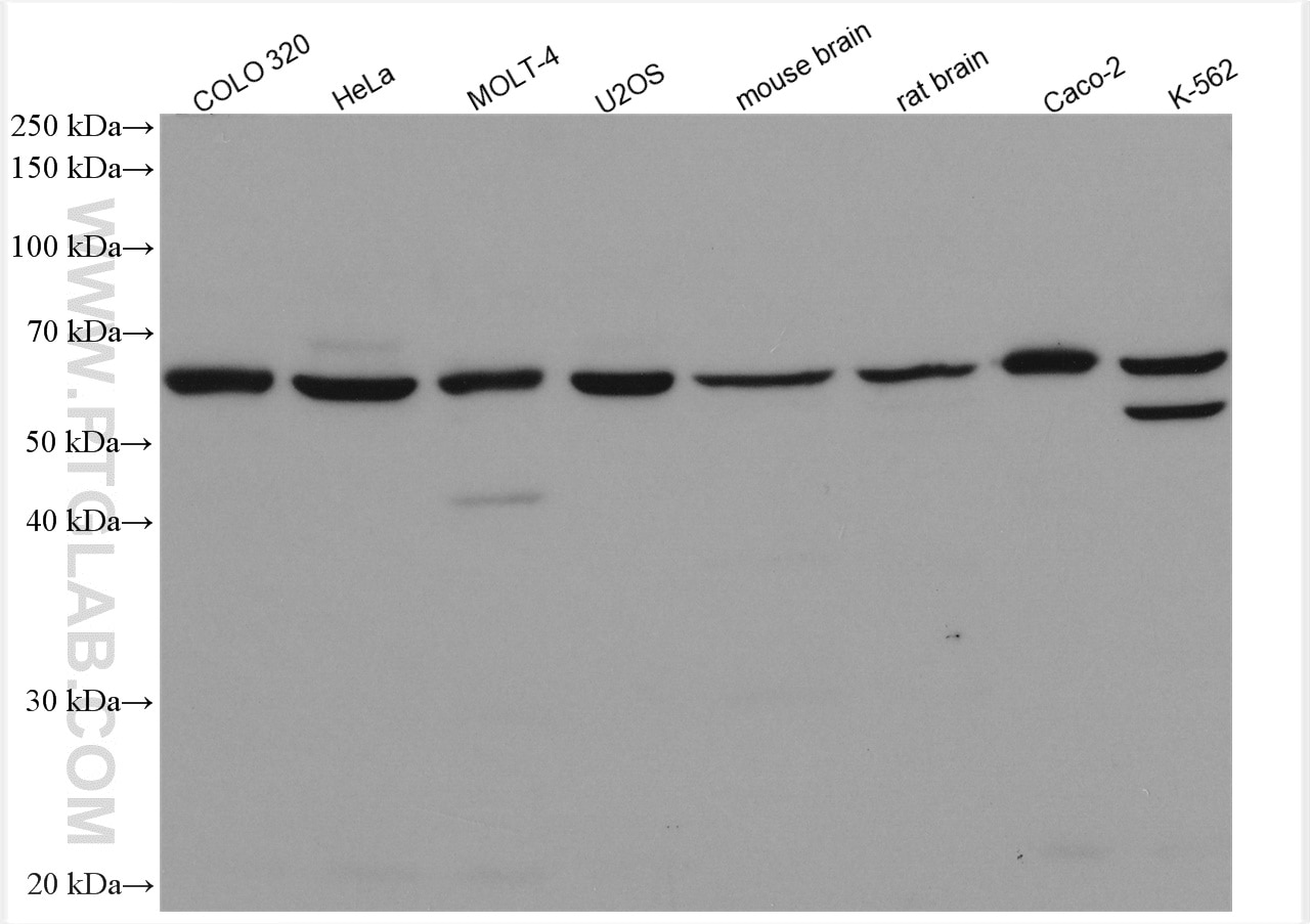 Western Blot (WB) analysis of various lysates using RGMA Polyclonal antibody (12387-1-AP)