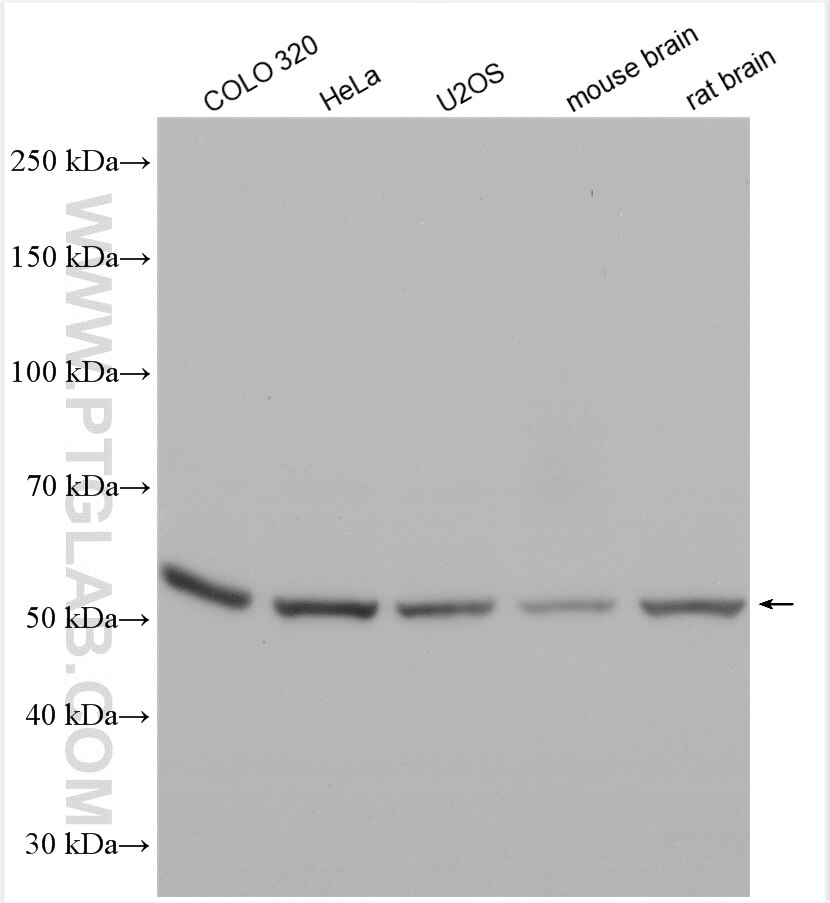 Western Blot (WB) analysis of various lysates using RGMA Polyclonal antibody (12387-1-AP)