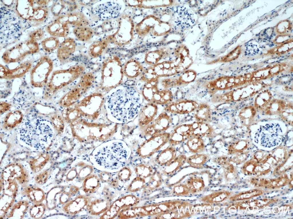 Immunohistochemistry (IHC) staining of human kidney tissue using RGN/SMP30 Polyclonal antibody (17947-1-AP)