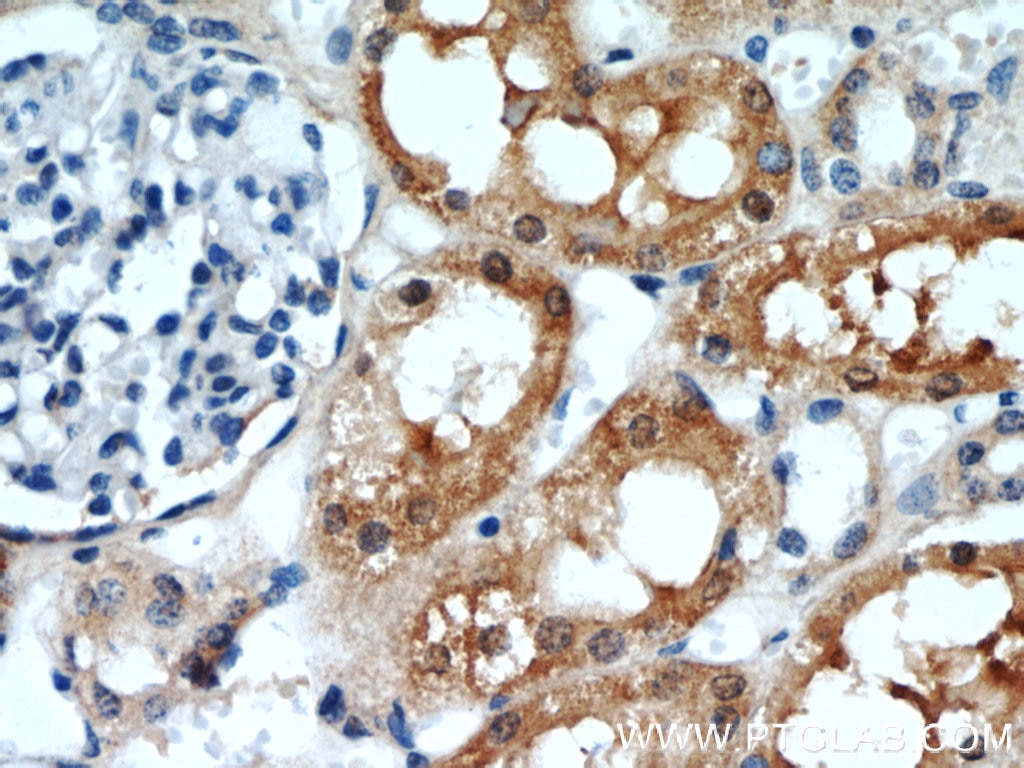 Immunohistochemistry (IHC) staining of human kidney tissue using RGN/SMP30 Polyclonal antibody (17947-1-AP)