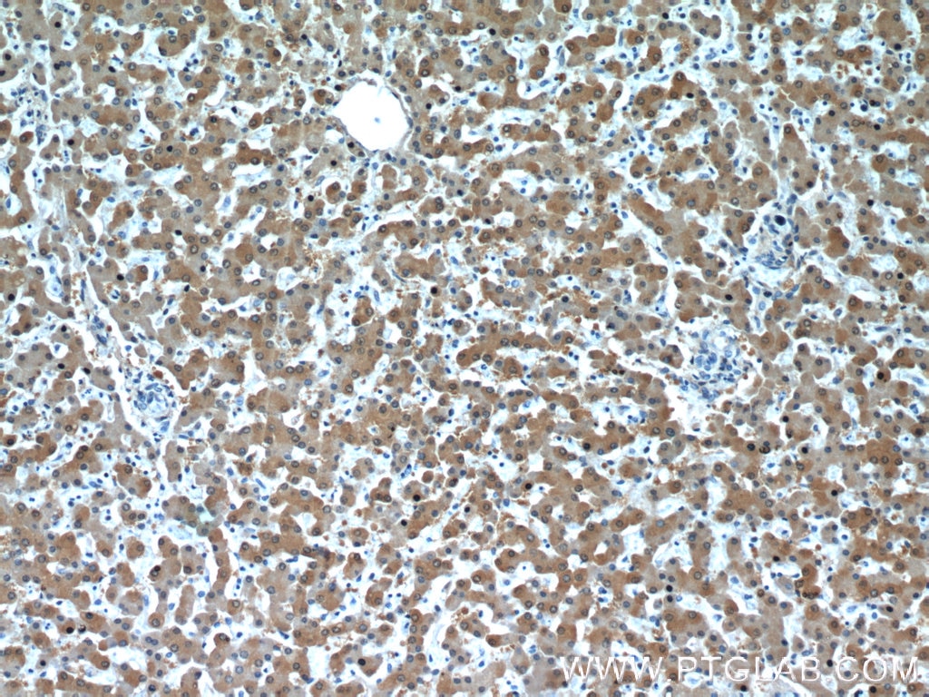 Immunohistochemistry (IHC) staining of human liver tissue using RGN/SMP30 Polyclonal antibody (17947-1-AP)