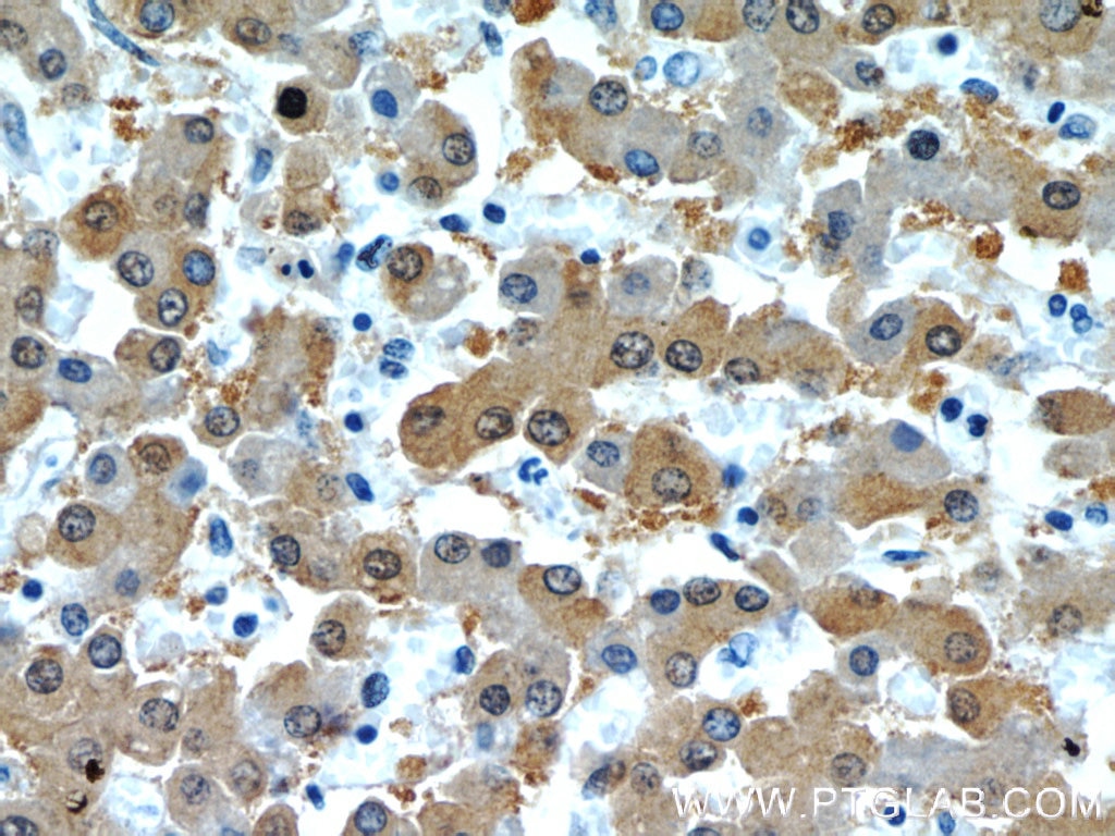Immunohistochemistry (IHC) staining of human liver tissue using RGN/SMP30 Polyclonal antibody (17947-1-AP)
