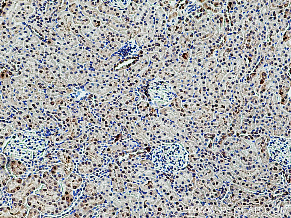 Immunohistochemistry (IHC) staining of rat kidney tissue using RGN/SMP30 Polyclonal antibody (17947-1-AP)