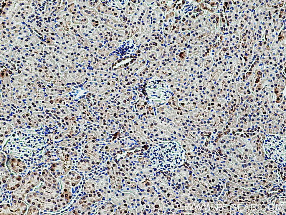 IHC staining of rat kidney using 17947-1-AP