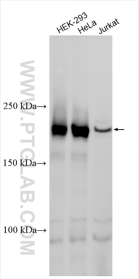 Western Blot (WB) analysis of various lysates using ARHGEF28 Polyclonal antibody (17144-1-AP)