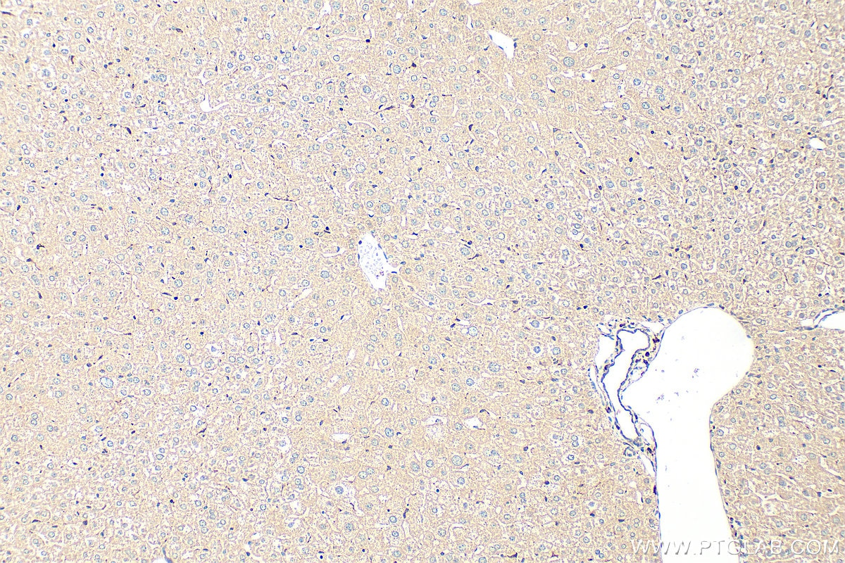 Immunohistochemistry (IHC) staining of mouse liver tissue using RGPD5 Polyclonal antibody (31636-1-AP)