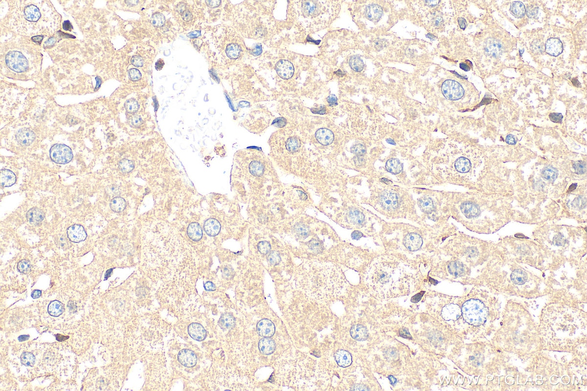 Immunohistochemistry (IHC) staining of mouse liver tissue using RGPD5 Polyclonal antibody (31636-1-AP)