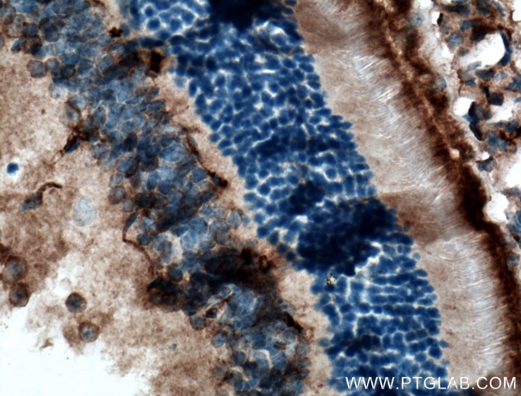 Immunohistochemistry (IHC) staining of mouse retina tissue using RGR Polyclonal antibody (11904-1-AP)