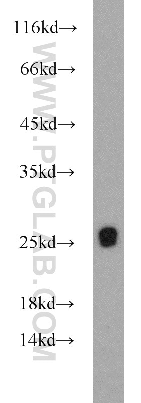 Western Blot (WB) analysis of human heart tissue using RGR Polyclonal antibody (11904-1-AP)