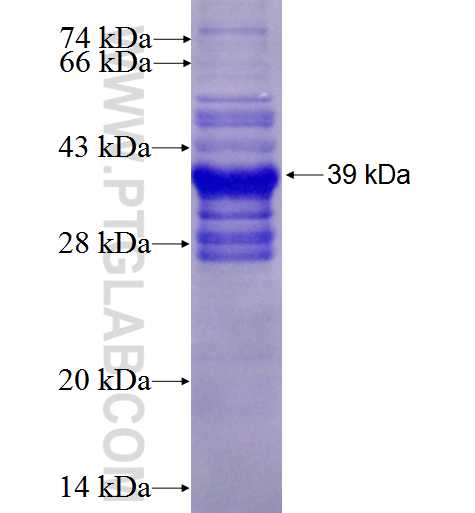 RGR fusion protein Ag2552 SDS-PAGE