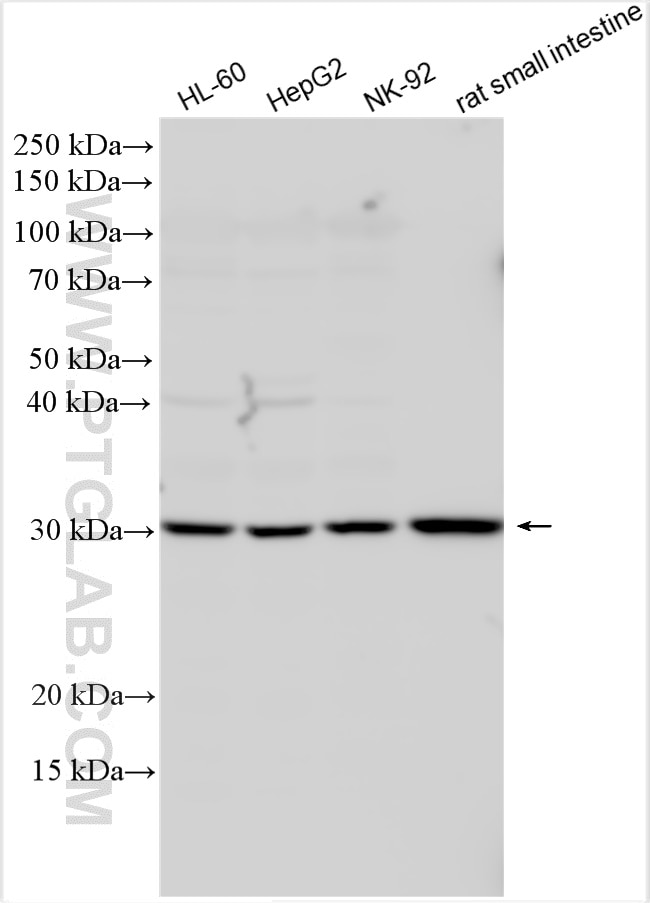 Western Blot (WB) analysis of various lysates using RGS1 Polyclonal antibody (12547-1-AP)