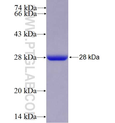 RGS1 fusion protein Ag3315 SDS-PAGE