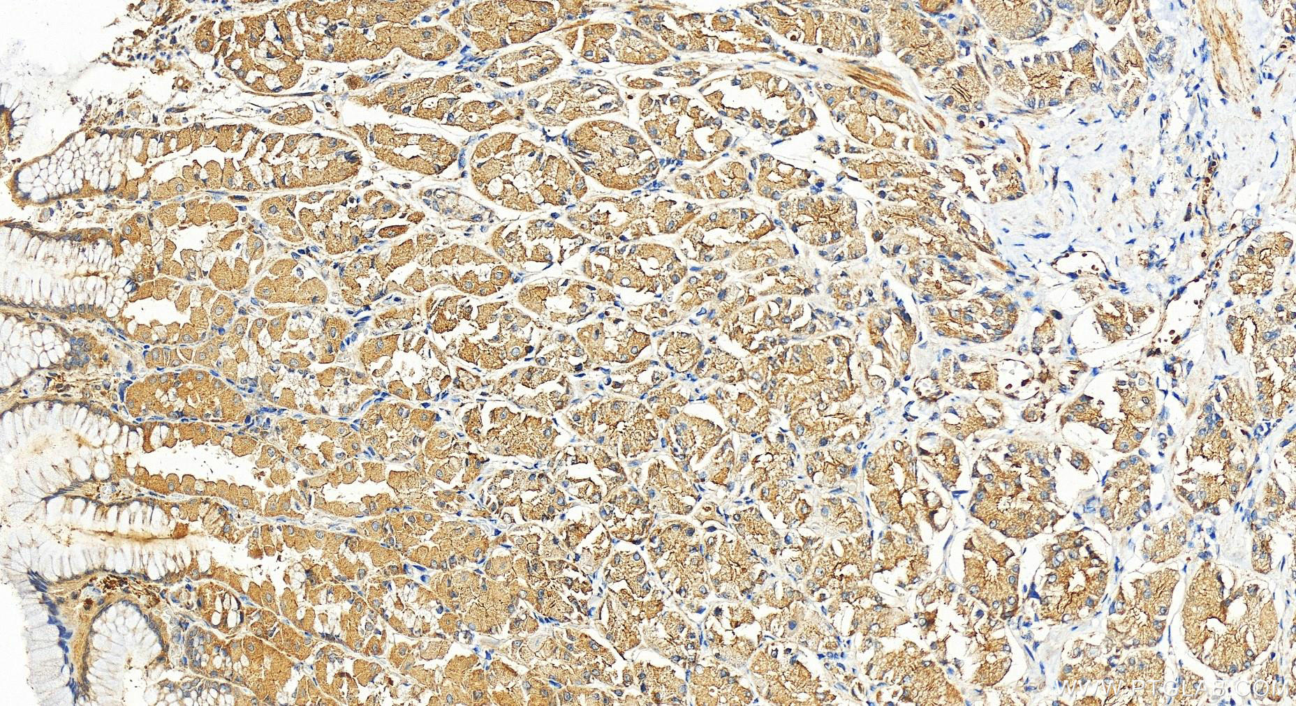 Immunohistochemistry (IHC) staining of human stomach tissue using RGS10 Polyclonal antibody (11163-1-AP)