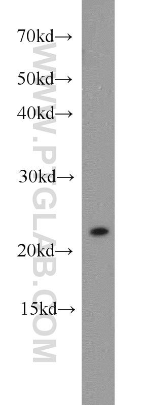 Western Blot (WB) analysis of K-562 cells using RGS10 Polyclonal antibody (11163-1-AP)