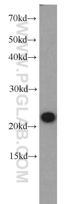 Western Blot (WB) analysis of mouse thymus tissue using RGS10 Polyclonal antibody (11163-1-AP)