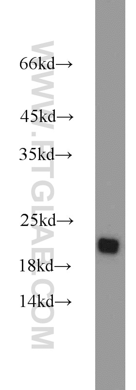 Western Blot (WB) analysis of mouse thymus tissue using RGS10 Polyclonal antibody (11163-1-AP)