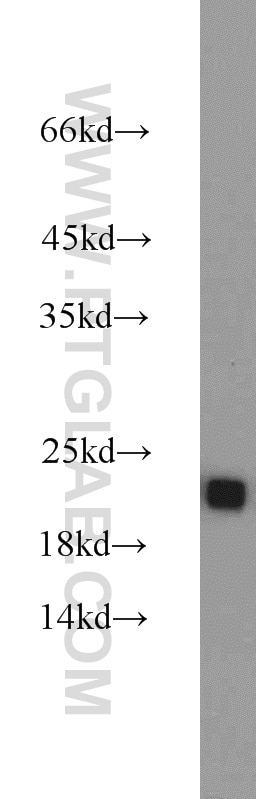 Western Blot (WB) analysis of mouse thymus tissue using RGS10 Polyclonal antibody (11163-1-AP)