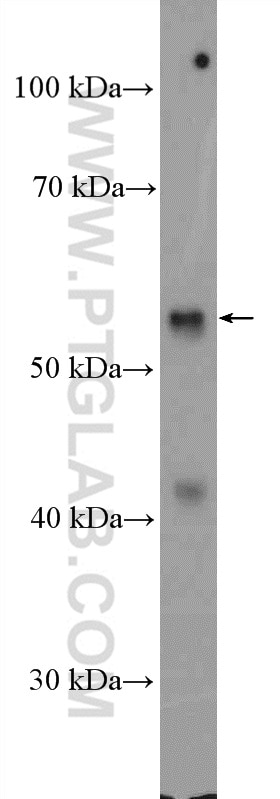 Western Blot (WB) analysis of rat brain tissue using RGS11 Polyclonal antibody (26132-1-AP)