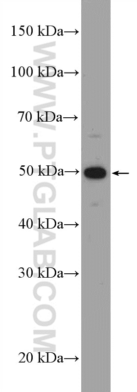 Western Blot (WB) analysis of HL-60 cells using RGS11 Polyclonal antibody (26132-1-AP)