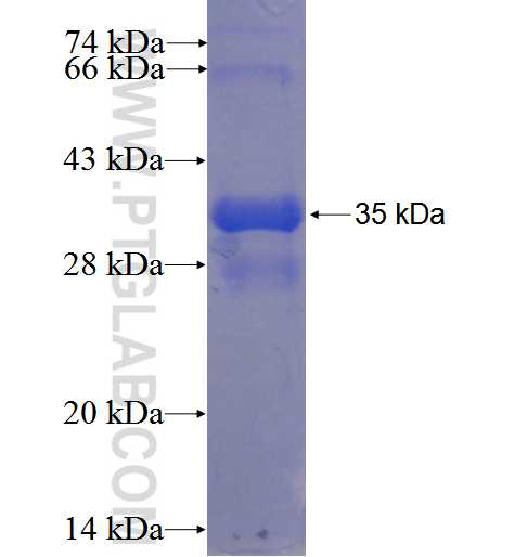 RGS11 fusion protein Ag23562 SDS-PAGE