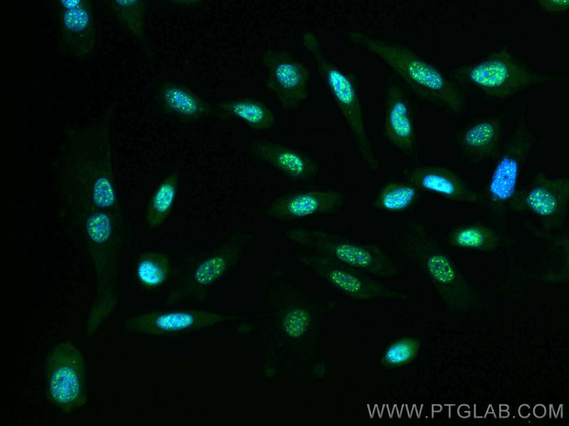Immunofluorescence (IF) / fluorescent staining of PC-3 cells using RGS12 Polyclonal antibody (29803-1-AP)