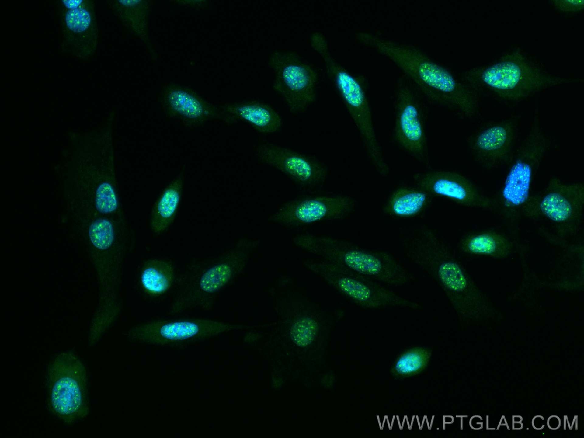 IF Staining of PC-3 using 29803-1-AP