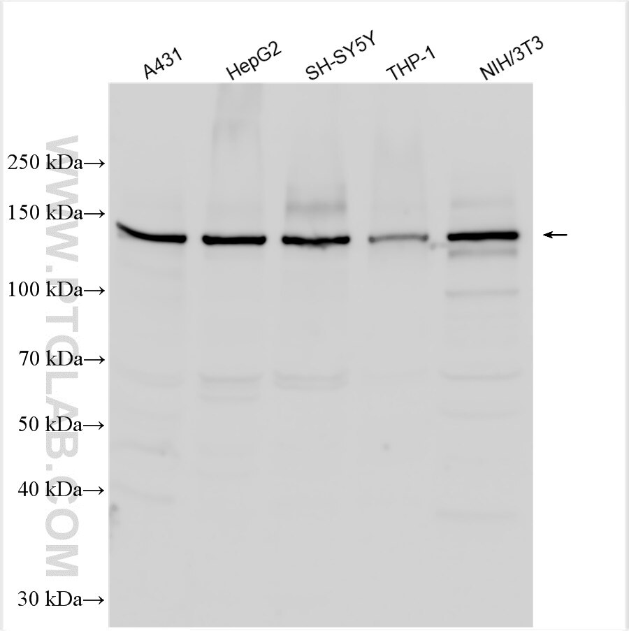 Western Blot (WB) analysis of various lysates using RGS12 Polyclonal antibody (29803-1-AP)