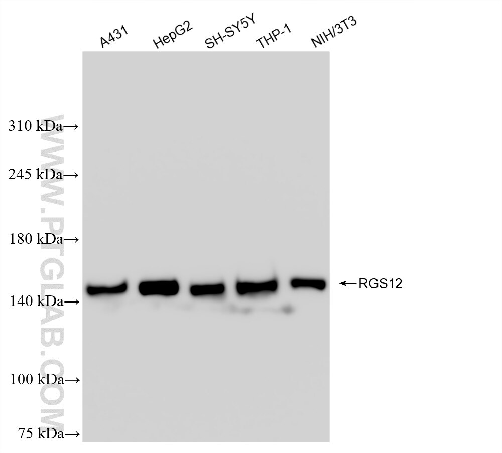 Western Blot (WB) analysis of various lysates using RGS12 Recombinant antibody (85057-2-RR)