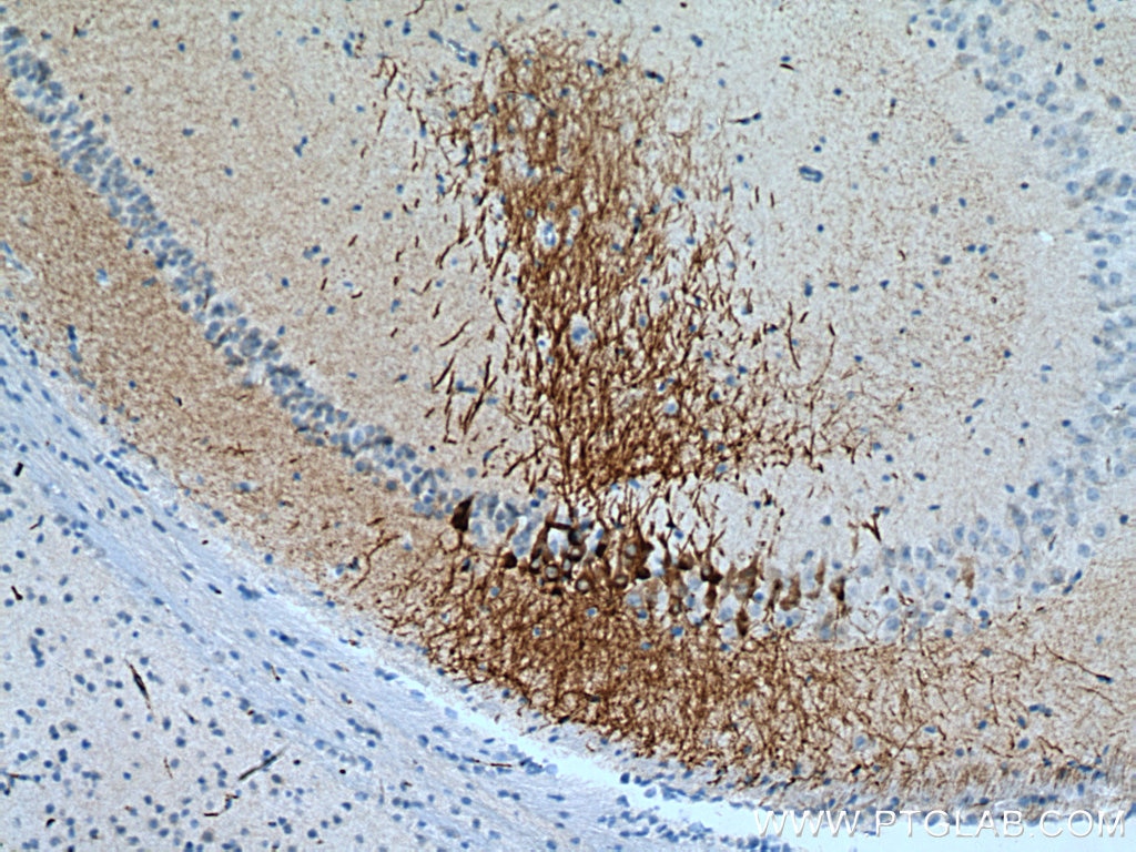 Immunohistochemistry (IHC) staining of mouse brain tissue using RGS14 Polyclonal antibody (16258-1-AP)