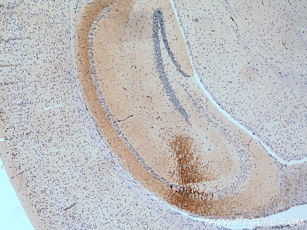 Immunohistochemistry (IHC) staining of mouse brain tissue using RGS14 Polyclonal antibody (16258-1-AP)