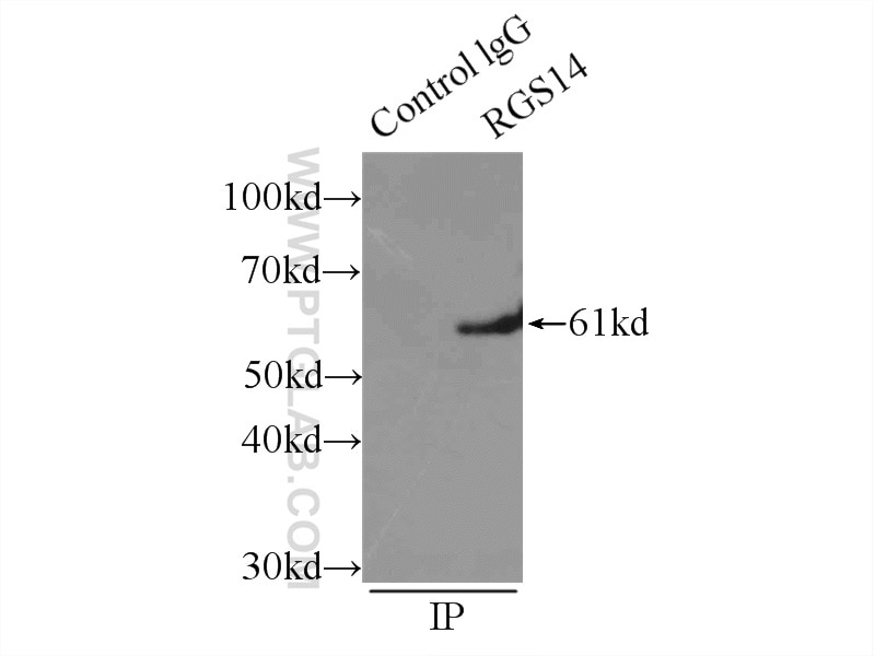 Immunoprecipitation (IP) experiment of mouse brain tissue using RGS14 Polyclonal antibody (16258-1-AP)