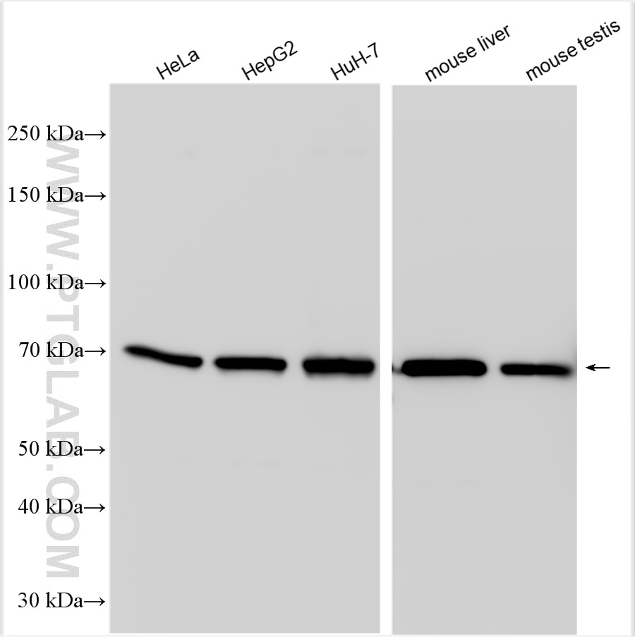 Western Blot (WB) analysis of various lysates using RGS14 Polyclonal antibody (16258-1-AP)