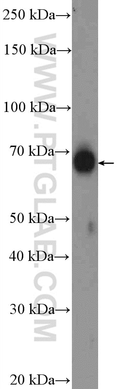 Western Blot (WB) analysis of mouse testis tissue using RGS14 Polyclonal antibody (16258-1-AP)