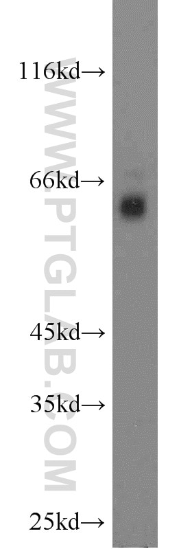 Western Blot (WB) analysis of mouse brain tissue using RGS14 Polyclonal antibody (16258-1-AP)