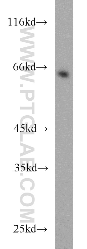 Western Blot (WB) analysis of mouse spleen tissue using RGS14 Polyclonal antibody (16258-1-AP)
